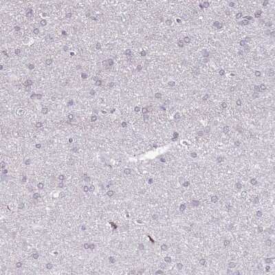 Immunohistochemistry-Paraffin: BANK1 Antibody [NBP1-88714]