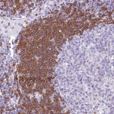 Immunohistochemistry-Paraffin: BANK1 Antibody [NBP1-88714]