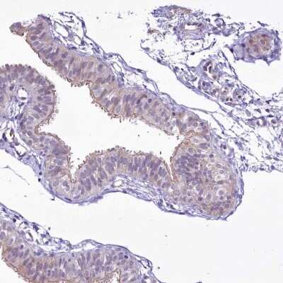 Immunohistochemistry-Paraffin: BANK1 Antibody [NBP1-88714]