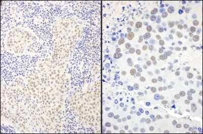 Immunohistochemistry: BANP Antibody [NB100-79784]