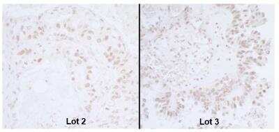 Immunohistochemistry: BANP Antibody [NB100-79784]