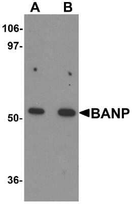 Western Blot: BANP AntibodyBSA Free [NBP1-76295]