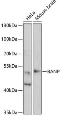 Western Blot: BANP AntibodyBSA Free [NBP3-04596]