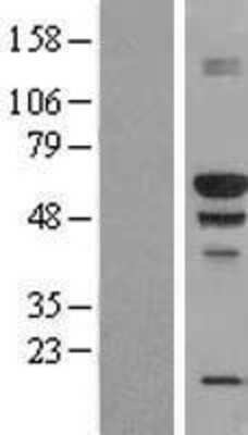 Western Blot: BANP Overexpression Lysate [NBP2-09955]