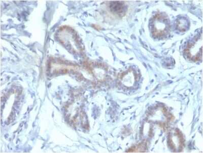 Immunohistochemistry-Paraffin: BAP1 Antibody (BAP1/2433) - Azide and BSA Free [NBP3-08494]