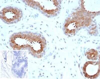 Immunohistochemistry-Paraffin: BAP1 Antibody (BAP1/6861R) [NBP3-13801]