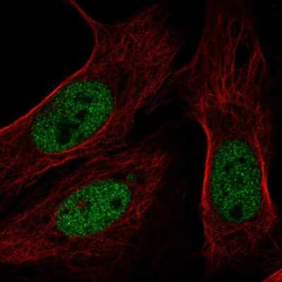 Immunocytochemistry/ Immunofluorescence: BAP1 Antibody [NBP2-55462]