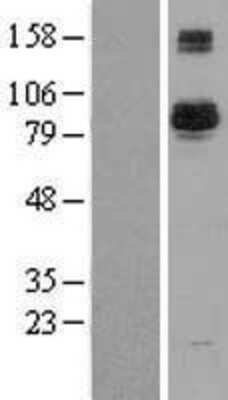 Western Blot: BAP1 Overexpression Lysate [NBL1-07915]