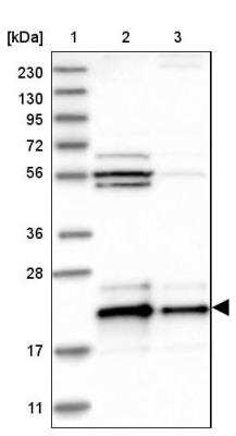 Western Blot: BAP18 Antibody [NBP1-82670]