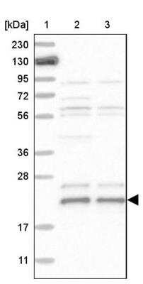 Western Blot: BAP18 Antibody [NBP1-82671]