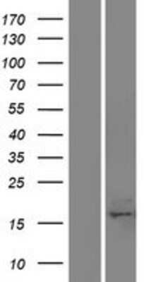 Western Blot: BAP18 Overexpression Lysate [NBP2-05073]