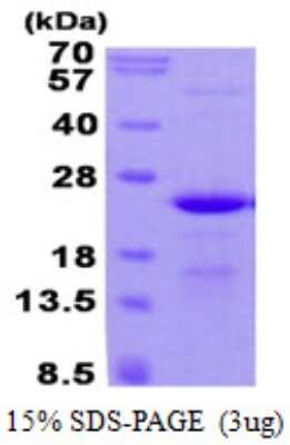 SDS-PAGE: Recombinant Human BAP18 His Protein [NBP2-22781]