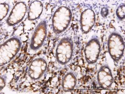 Immunohistochemistry-Paraffin: BAP29 Antibody (4B10) [H00055973-M07]