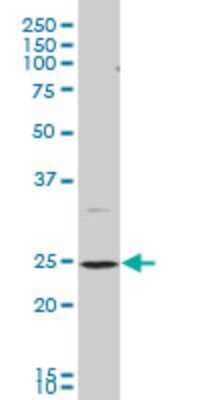 Western Blot: BAP29 Antibody (4B10) [H00055973-M07]