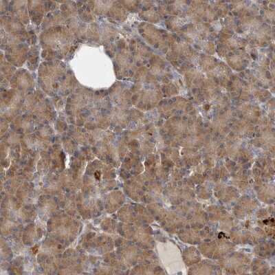 Immunohistochemistry-Paraffin: BAP29 Antibody [NBP1-90009]