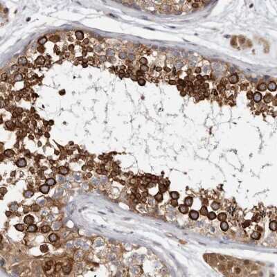 Immunohistochemistry-Paraffin: BAP29 Antibody [NBP1-90009]