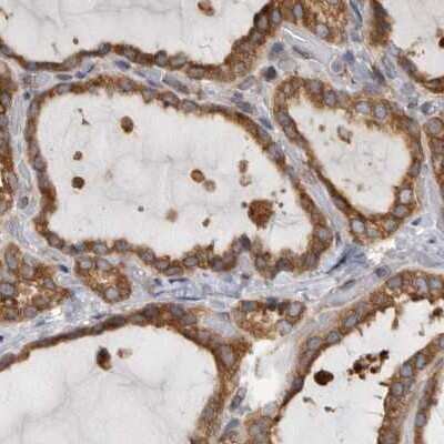 Immunohistochemistry-Paraffin: BAP29 Antibody [NBP1-90009]
