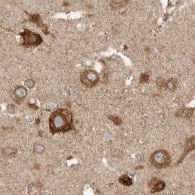 Immunohistochemistry-Paraffin: BAP29 Antibody [NBP1-90009]