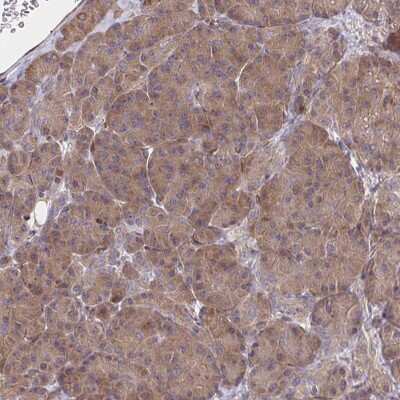 Immunohistochemistry-Paraffin: BAP29 Antibody [NBP2-38606]