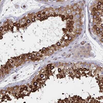 Immunohistochemistry-Paraffin: BAP29 Antibody [NBP2-38606]