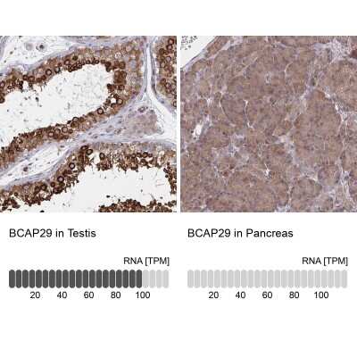Immunohistochemistry-Paraffin: BAP29 Antibody [NBP2-38606]