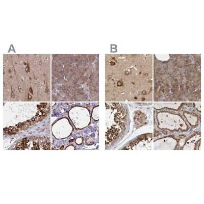 Immunohistochemistry-Paraffin: BAP29 Antibody [NBP2-38606]