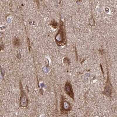 Immunohistochemistry-Paraffin: BAP29 Antibody [NBP2-38606]