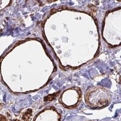 Immunohistochemistry-Paraffin: BAP29 Antibody [NBP2-38606]