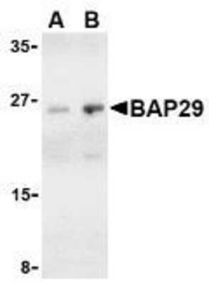 Western Blot: BAP29 AntibodyBSA Free [NBP1-76421]