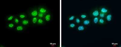 Immunocytochemistry/ Immunofluorescence: BARD1 Antibody [NBP3-13065]