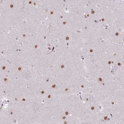 Immunohistochemistry: BARD1 Antibody [NBP2-47543]