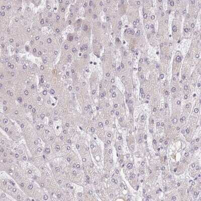Immunohistochemistry-Paraffin: BARD1 Antibody [NBP2-47543]
