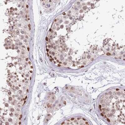 Immunohistochemistry-Paraffin: BARD1 Antibody [NBP2-47543]