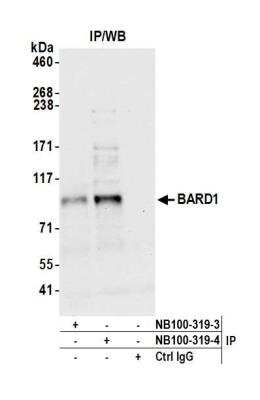 Immunoprecipitation: BARD1 Antibody [NB100-319]