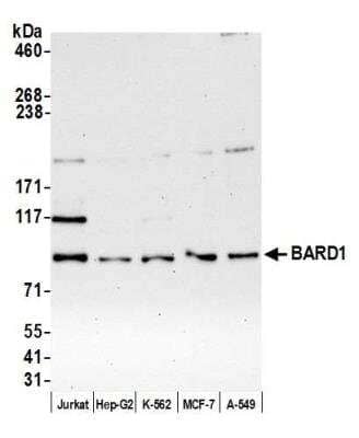 Western Blot: BARD1 Antibody [NB100-319]