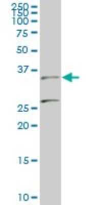 Western Blot: BARHL1 Antibody (2B11) [H00056751-M01]
