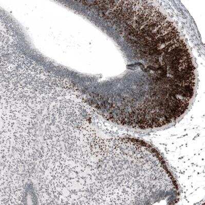 Immunohistochemistry-Paraffin: BARHL1 Antibody [NBP1-86513]