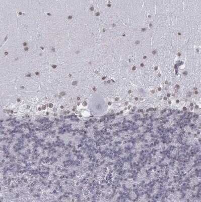 Immunohistochemistry-Paraffin: BARHL1 Antibody [NBP1-86513]