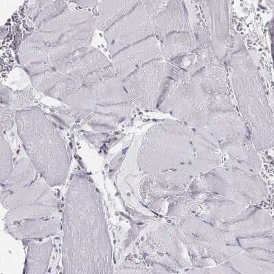 Immunohistochemistry-Paraffin: BARHL1 Antibody [NBP1-86513]