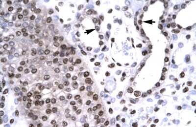 Immunohistochemistry: BARHL2 Antibody [NBP3-10922]