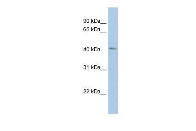 Western Blot: BARHL2 Antibody [NBP3-10600]