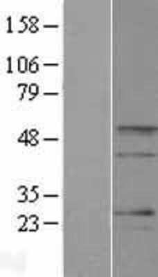 Western Blot: BARHL2 Overexpression Lysate [NBP2-06689]