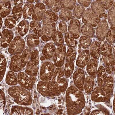 Immunohistochemistry-Paraffin: BASC4 Antibody [NBP1-85524]