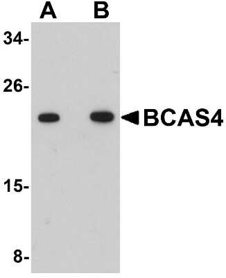 Western Blot: BASC4 AntibodyBSA Free [NBP1-77126]