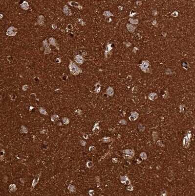 Immunohistochemistry-Paraffin: BASP1 Antibody [NBP2-14347]