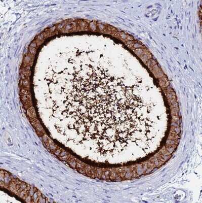 Immunohistochemistry-Paraffin: BASP1 Antibody [NBP2-14347]