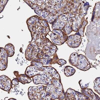 Immunohistochemistry-Paraffin: BASP1 Antibody [NBP2-14347]