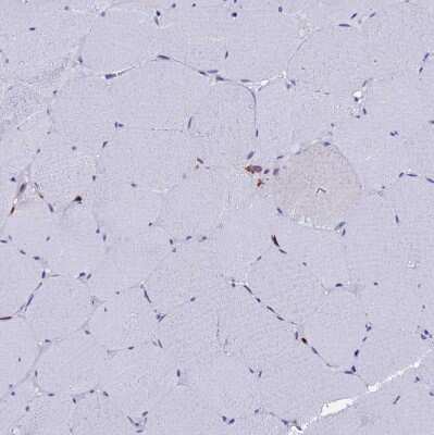 Immunohistochemistry-Paraffin: BASP1 Antibody [NBP2-14347]