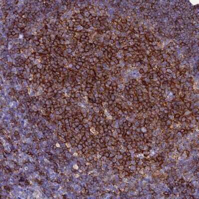 Immunohistochemistry-Paraffin: BASP1 Antibody [NBP2-14347]