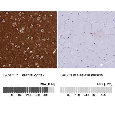 Immunohistochemistry-Paraffin: BASP1 Antibody [NBP2-14347]